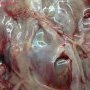 Ovarian mucinous cystadenoma