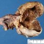 Ovarian luteal cyst (afetr formalin fixation)