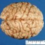 Brain (6 months)