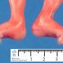 Flexion of fingers
