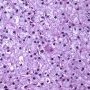 Lipofuscin in Kuppfer cells