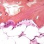 Osteoclast