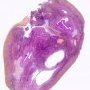 Normal ovary (21 years)
