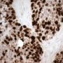 Ki67 immunostaining