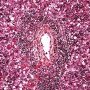 Periportal hematopoiesis (Fetus, 32 weeks)