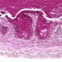 Meconium in fetal colon (24 weeks)