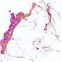 Hypodermal adipose tissue