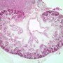 Fetal kidney