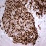 Desmin immunostaining