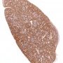 Spleen CD68