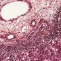 Periportal hematopoiesis (Fetus, 32 weeks)