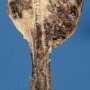 Humoral osteosarcoma after formalin fixation