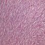 Monophasic synovial sarcoma