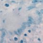 Ziehl–Neelsen stain (Courtesy of Dr Yale Rosen)