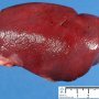 Spleen
