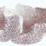 Kidney - EMA immunolabelling