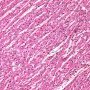 Normal myocardium