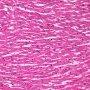 Normal myocardium