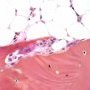 Osteoclast