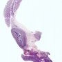 Fetal ovaries (21 weeks)