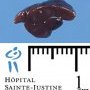 Multilobated spleen