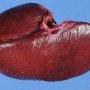 Normal spleen (splenectomy for thrombocytopenia)