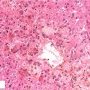 Centrilobular cholestasis.