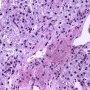 Lipofuscin in portal macrophages