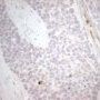 NH2-WT1 immunostaining