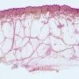 Hypodermis