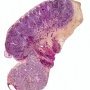 Testis and epididymis (neonate)
