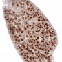 Spleen CD20