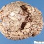 Normal brain