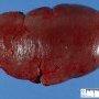 Spleen