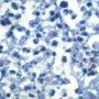 Ziehl–Neelsen stain (Courtesy of Dr Yale Rosen)