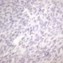 Cytokeratin