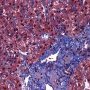 Lipofuscin in portal macrophages