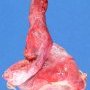 Testis (adult)