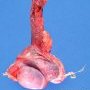 Testis (adult)