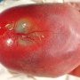 Aplasia cutis in 22 weeks fetus with alobar holoprosencephaly (Case (...)