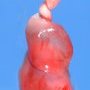 Umbilical cord stricture