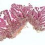 Normal intestinal villi