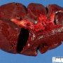 Hilus of the spleen