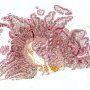 Normal intestinal villi
