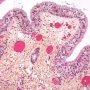 Bronchial mucosa