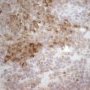 Cytokeratin immunostaining