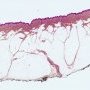 Hypodermis
