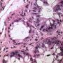 Colonic GVH