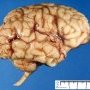 Brain (6 months)