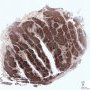 Lymphoid follicles in normal tonsil (CD3)